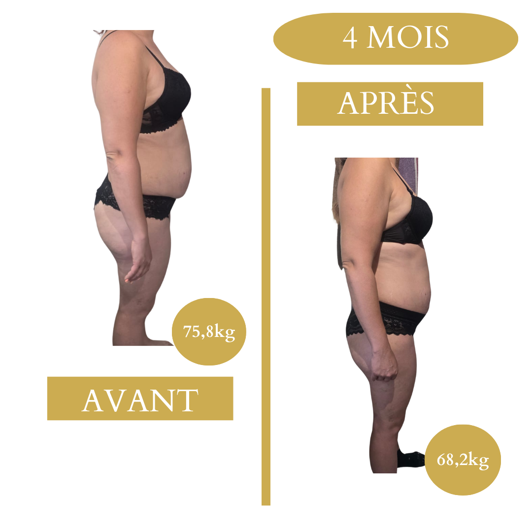 Avant/Après Emeline coaching sportif Nady Bakkouri à Langon